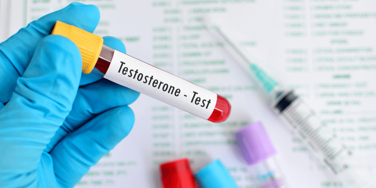 Testosterone blood test