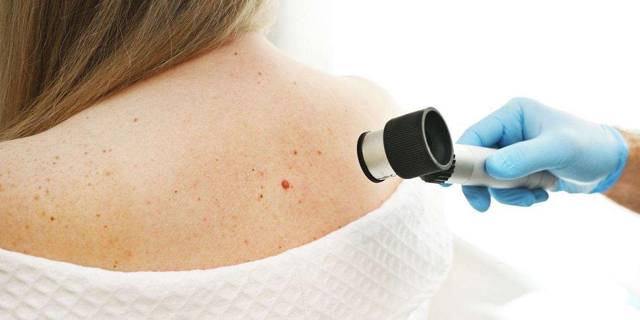 Doctor examining skin spot