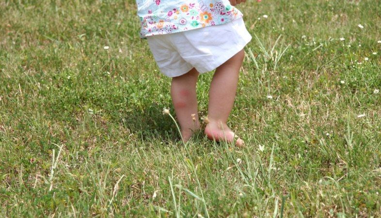 toddler-with-eczema-on-the-back-of-his-leg