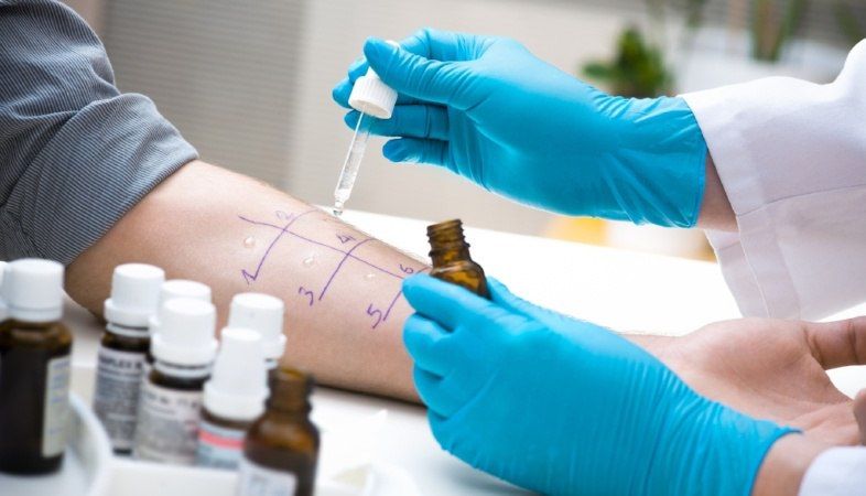 What is an Allergy Patch Test and Do You Need One?